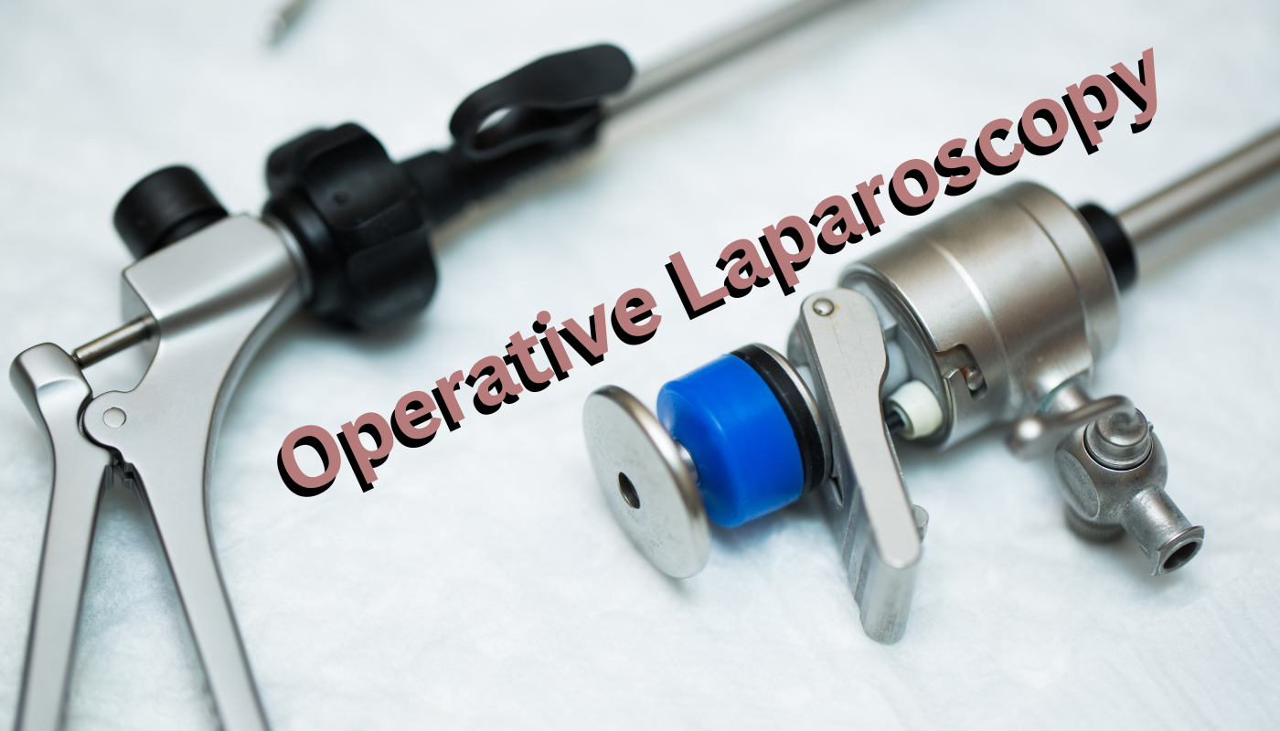 Operative Laparoscopy